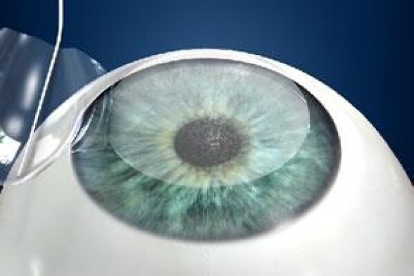 Visiomed Eye Laser Clinic