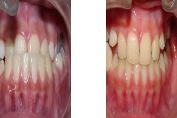 Jhb Orthodontist
