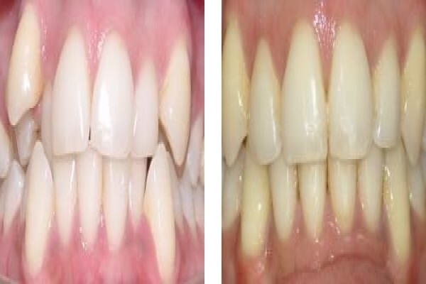 Jhb Orthodontist