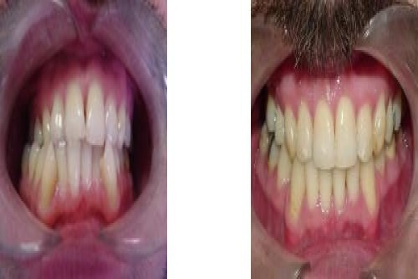 Jhb Orthodontist