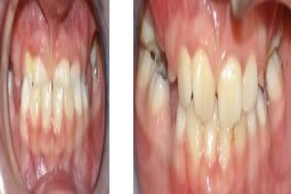 Jhb Orthodontist