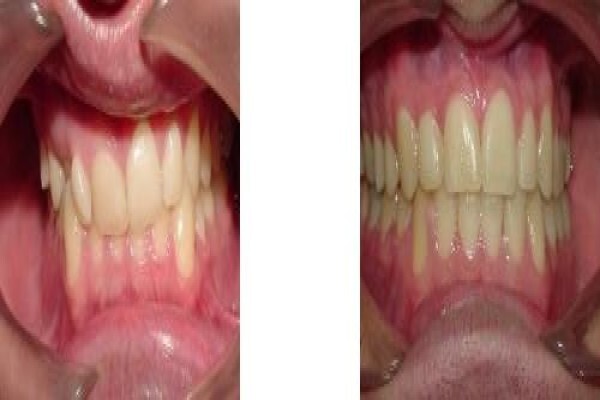 Jhb Orthodontist