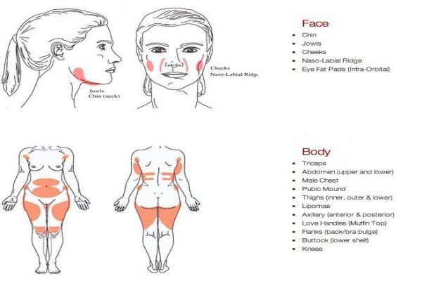 Laser Lipo South Africa