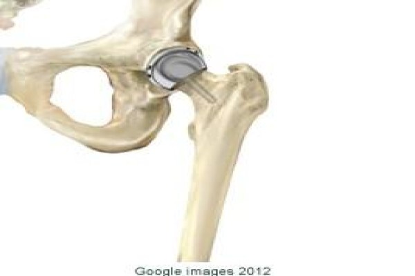 Capehipandknee