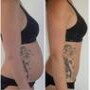 I-Lipo Lazer Centre
