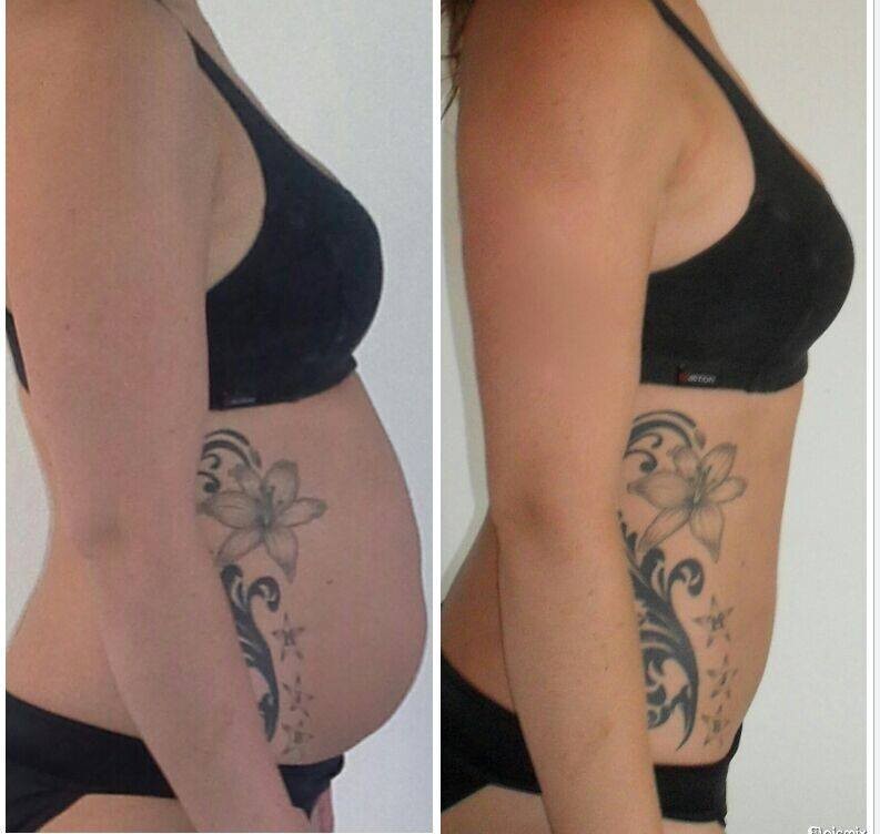 I-Lipo Lazer Centre