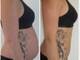 I-Lipo Lazer Centre