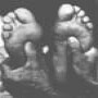 Reflexology 2000